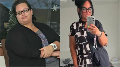 Many Lost Weight Using Injections – Arrived the Loose Skin